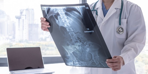 A radiologist looking at an X-ray.