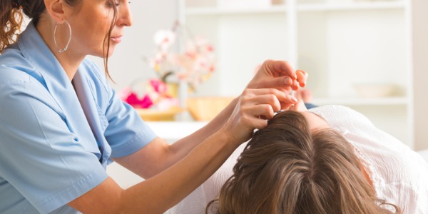 An acupuncturist using needles on a client's forehead.